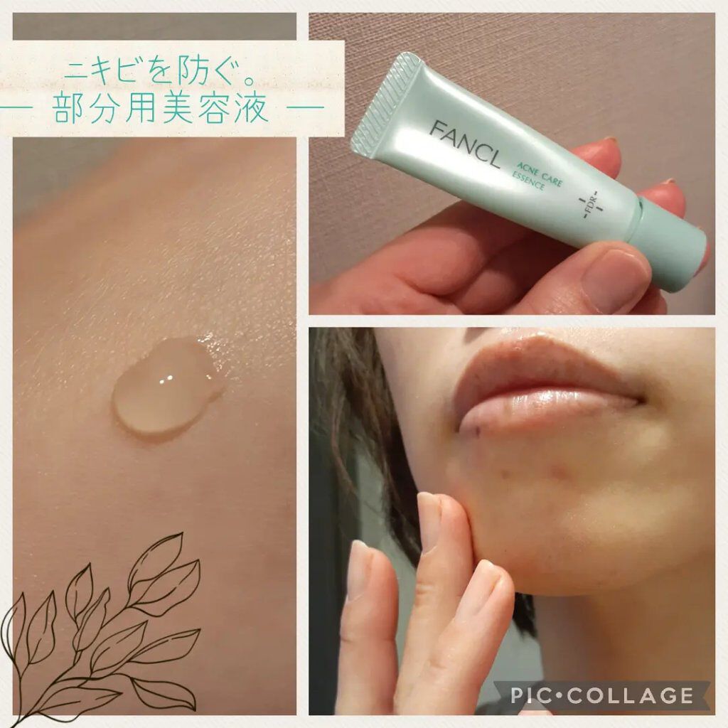 アクネケア 化粧液 <医薬部外品>/ファンケル/化粧水を使ったクチコミ(4枚目)