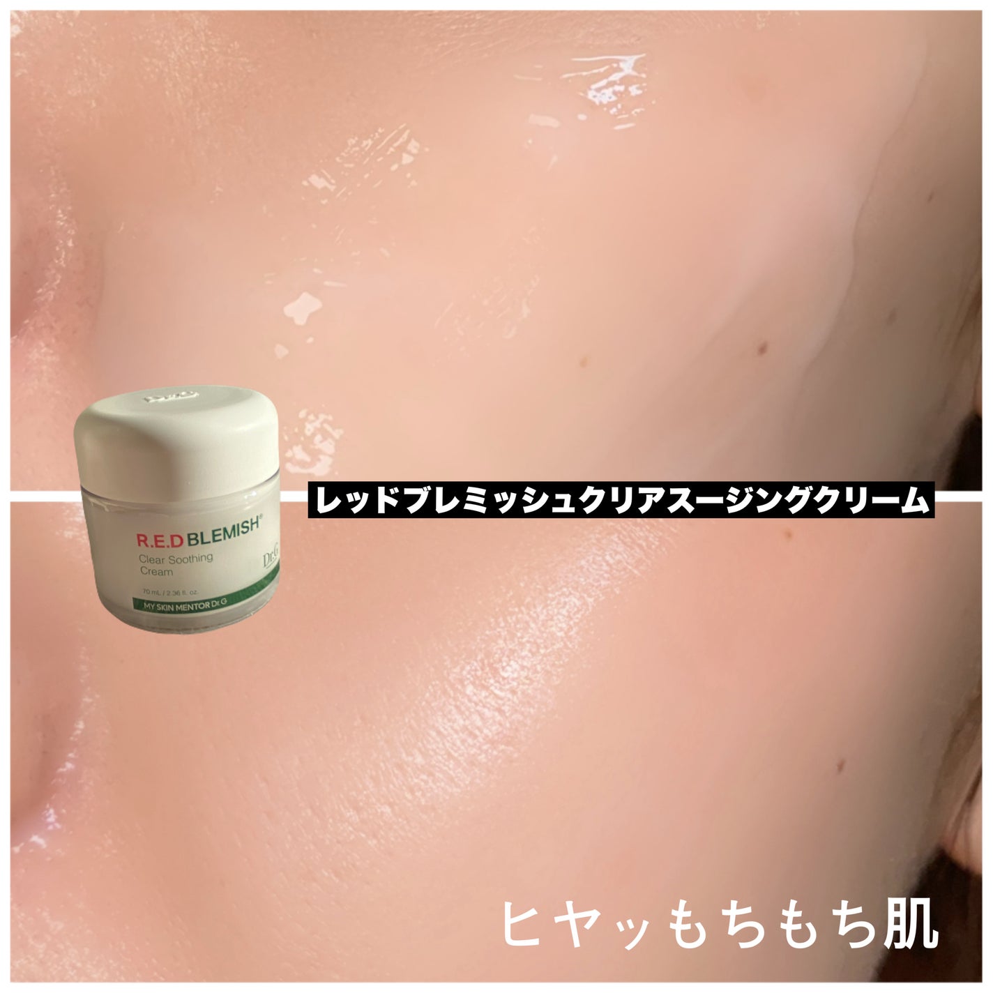 レッドブレミッシュクリアクイックスージングパック/Dr.G/拭き取り化粧水を使ったクチコミ(5枚目)