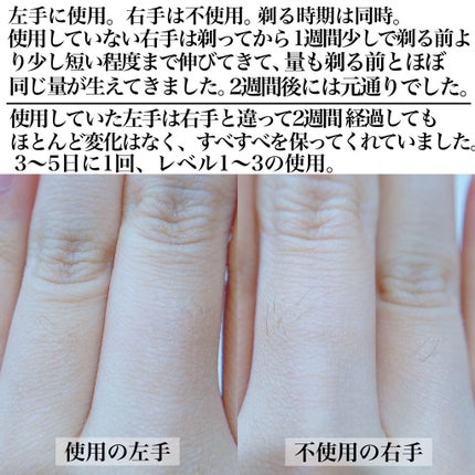 光美容器 光エステ ボディ&フェイス用 ハイパワー ゴールドES-CWP97-N/Panasonic/家庭用脱毛器を使ったクチコミ(4枚目)