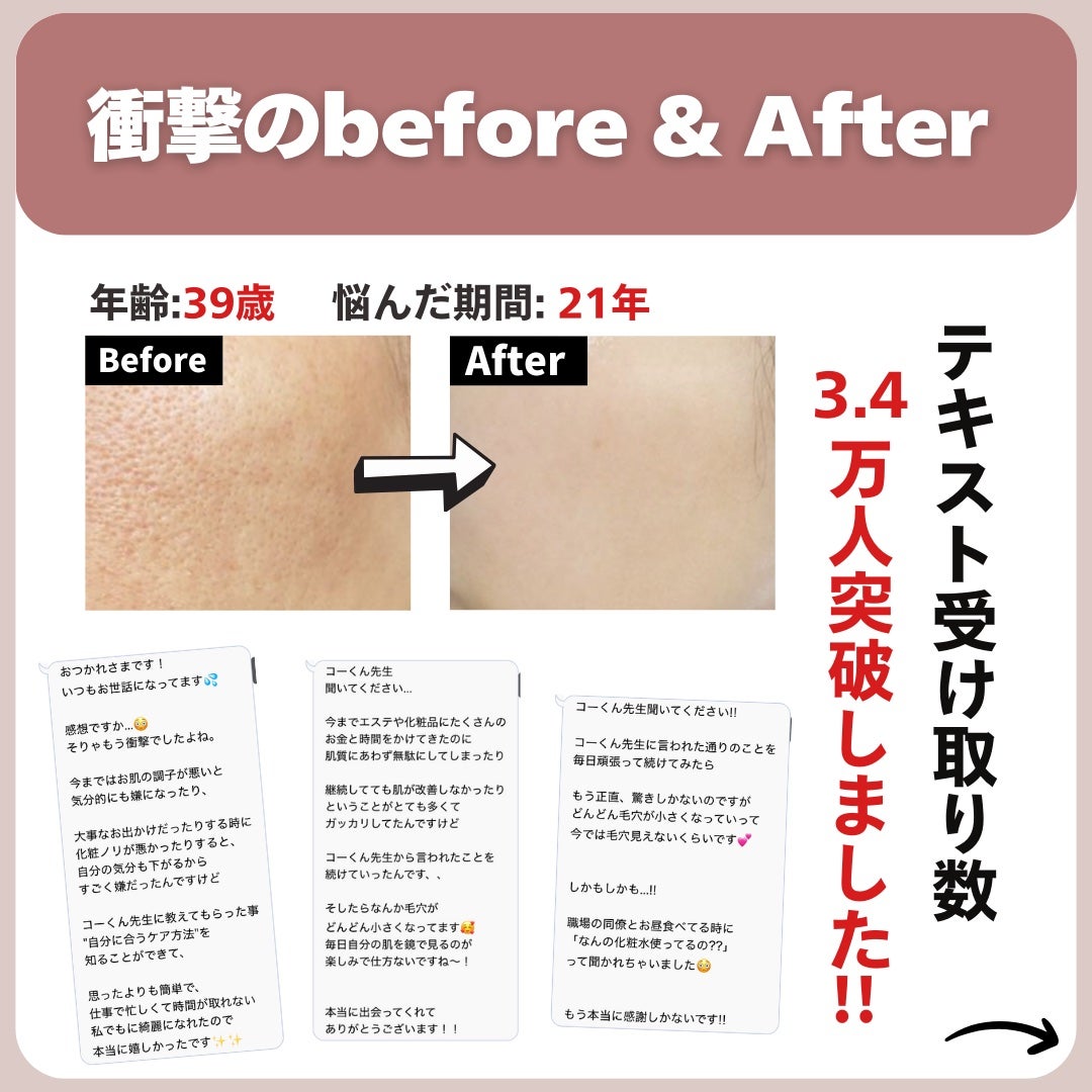 あなたの肌に合ったスキンケア💐コーくん先生 on LIPS 「【コレ知らない人まじ危険】こんな人は毛穴一生消えません。..あ..」(7枚目)