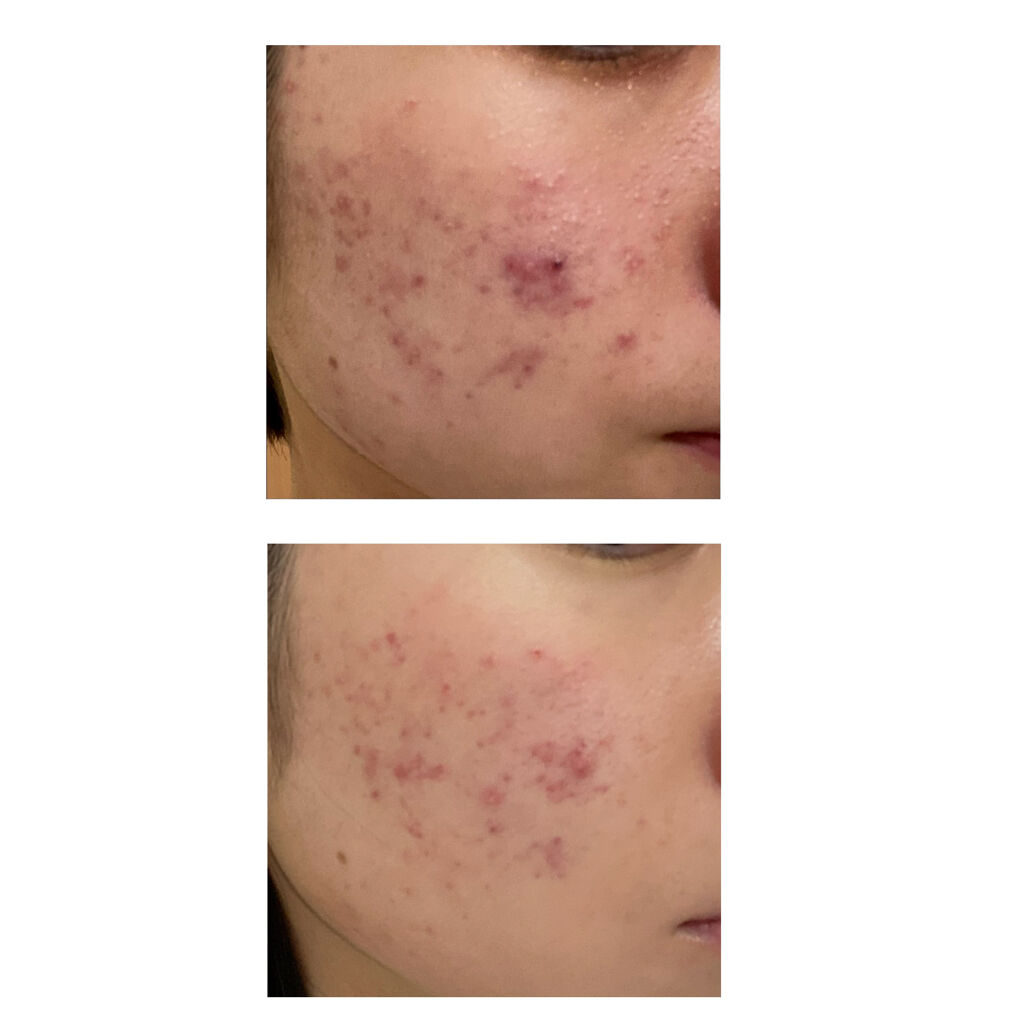 DHC ビタミンBミックス/DHC/美容サプリメントを使ったクチコミ（2枚目）