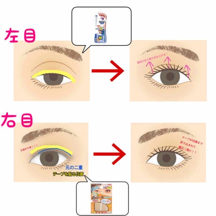 アイテープ(絆創膏タイプ、レギュラー、70枚)/DAISO/二重まぶた用アイテムを使ったクチコミ(3枚目)