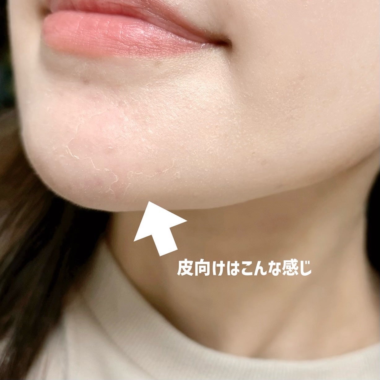 ダーマスキンピーリング/BQCELL/その他キットセットを使ったクチコミ(6枚目)