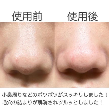 ノーモアブラックヘッド(ノーズピーリング)/One-day's you/スクラブ・ゴマージュを使ったクチコミ(4枚目)