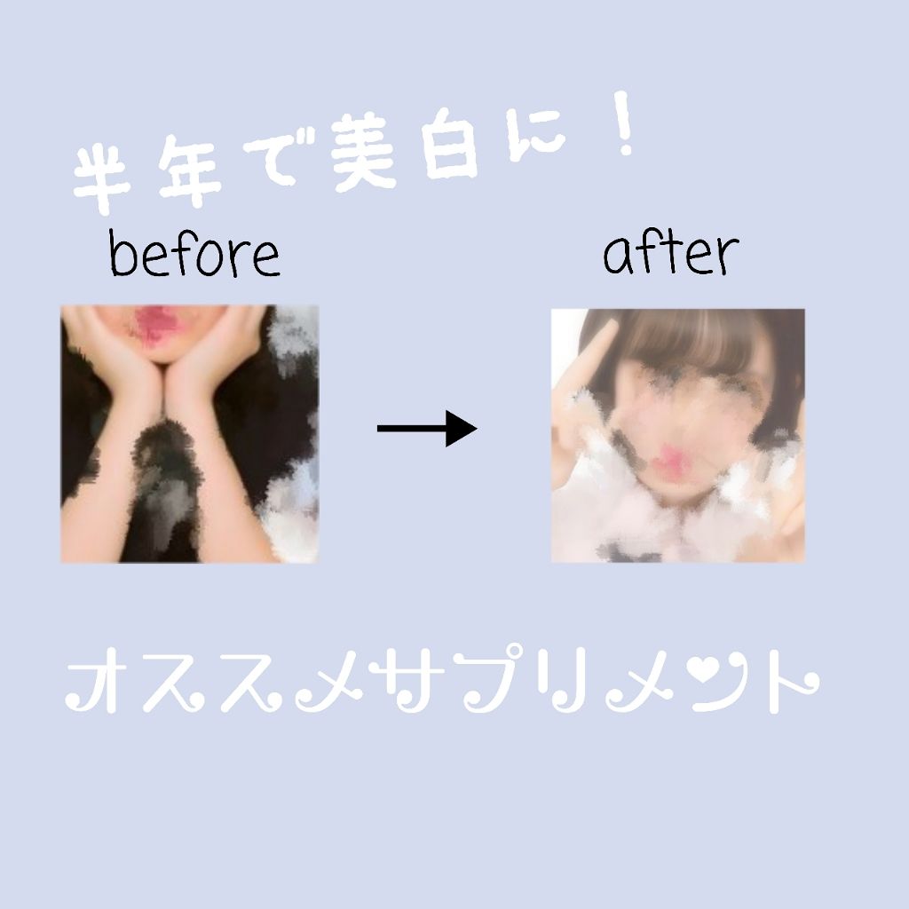 チョコラBBピュア (医薬品)/チョコラBB/その他を使ったクチコミ(1枚目)