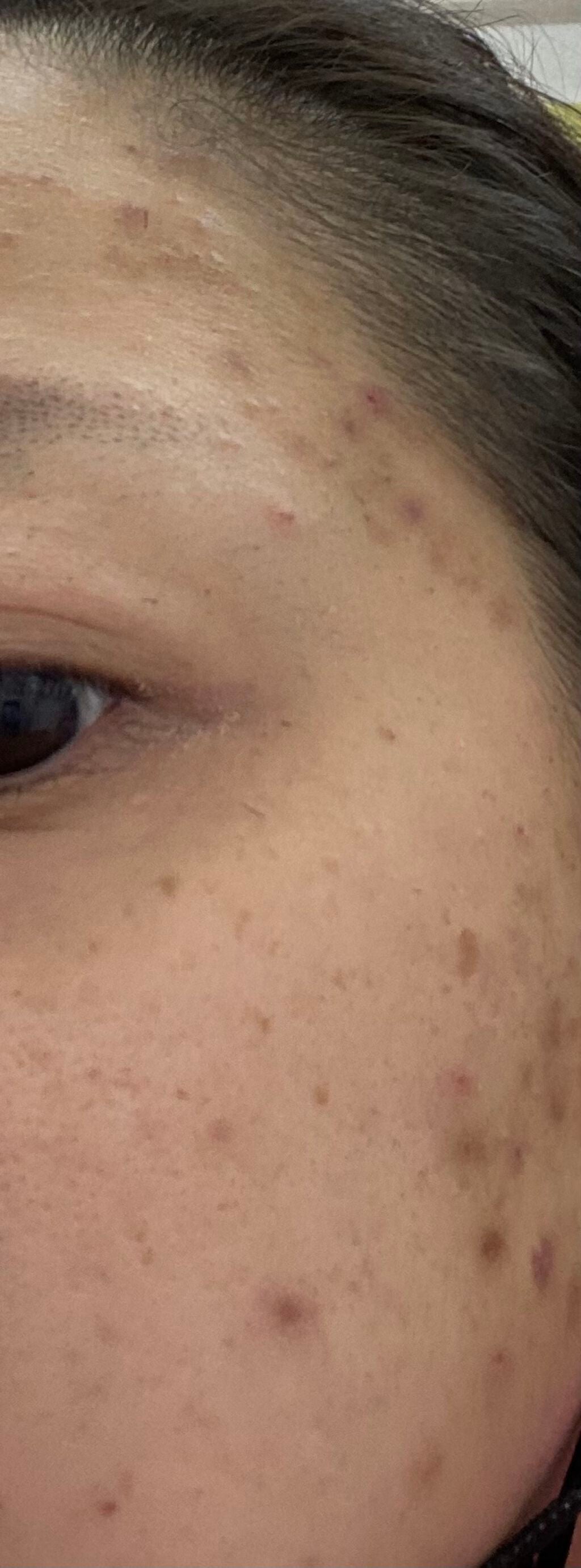 my's パーソナライズセラム/my's/美容液を使ったクチコミ(1枚目)