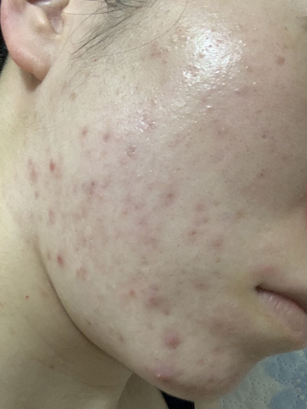 パーフェクトホイップn/SENKA（専科）/洗顔フォームを使ったクチコミ（2枚目）