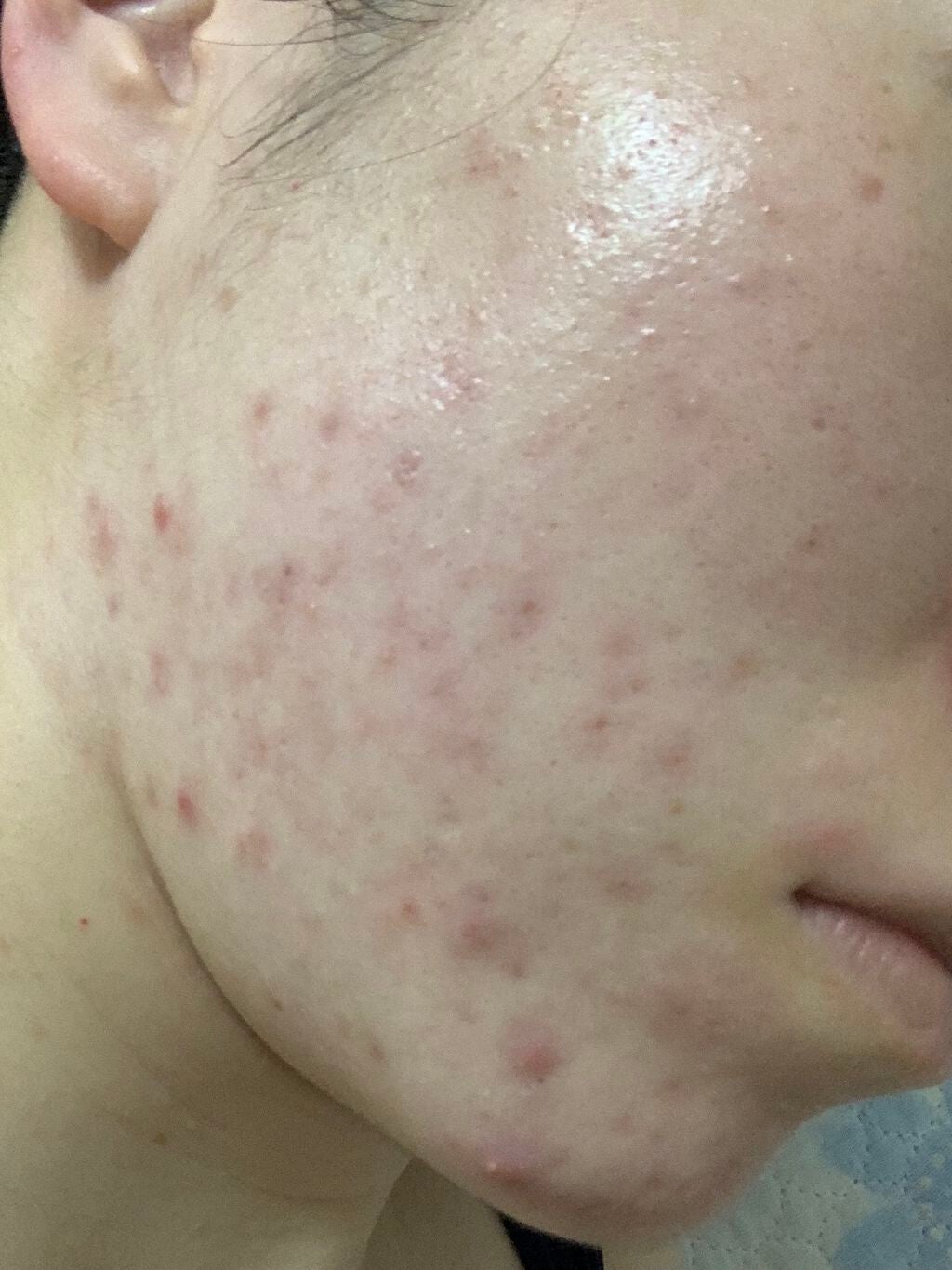 ザ・タイムR アクア/IPSA/化粧水を使ったクチコミ(2枚目)