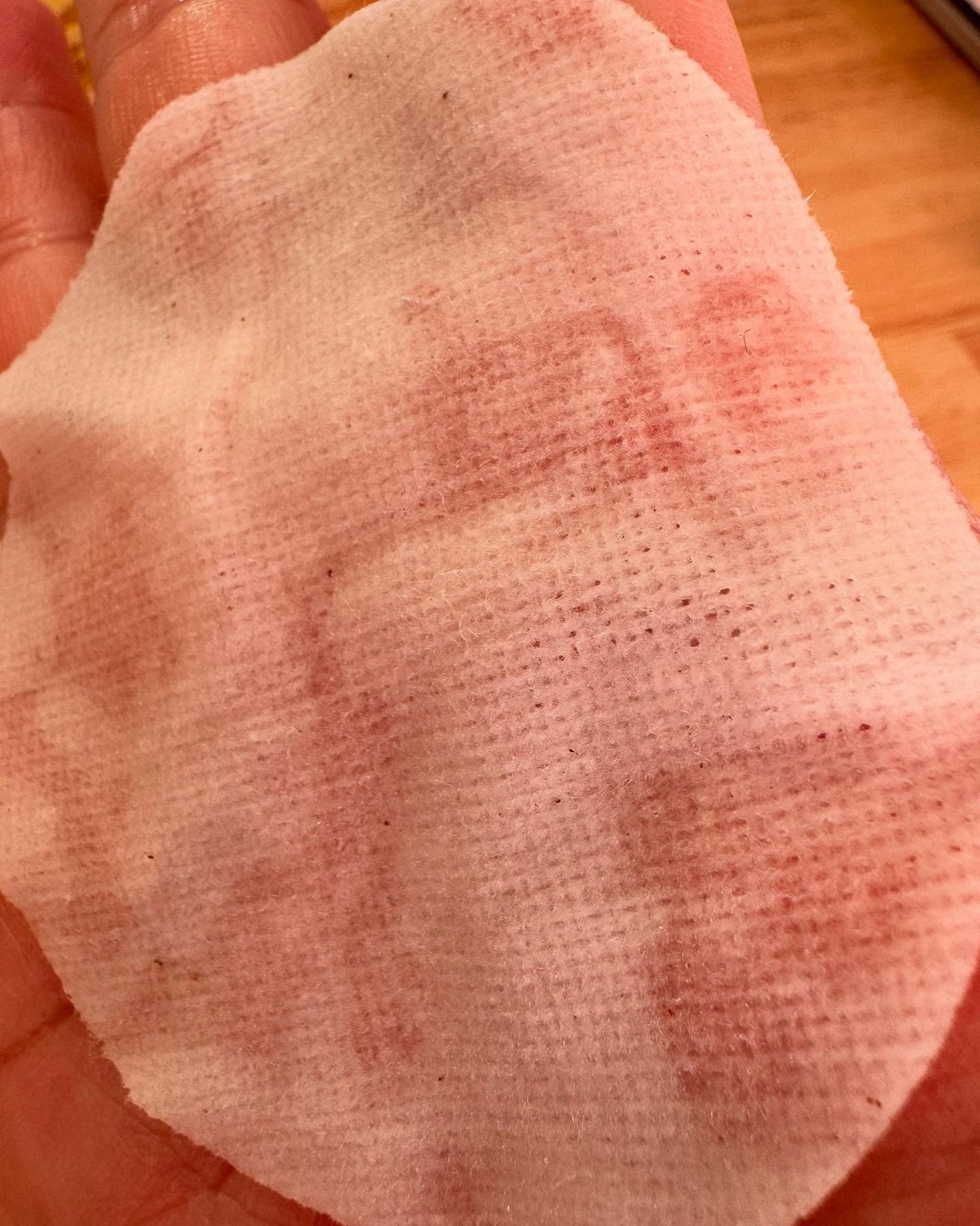 モイスチャーコラーゲン トナーパッド/tenzero/トナーパッドを使ったクチコミ(10枚目)