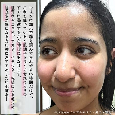 jasmine on LIPS 「＼肌荒れ・ニキビ・テカリの悩みに薬用化粧水🌿／☑️chanta..」（6枚目）