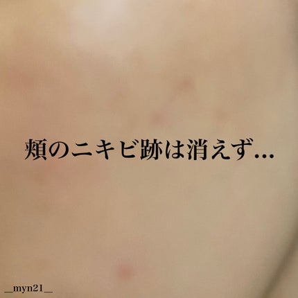 フレッシュリージュースドビタミンドロップ(35ml)/Klairs/美容液を使ったクチコミ(2枚目)