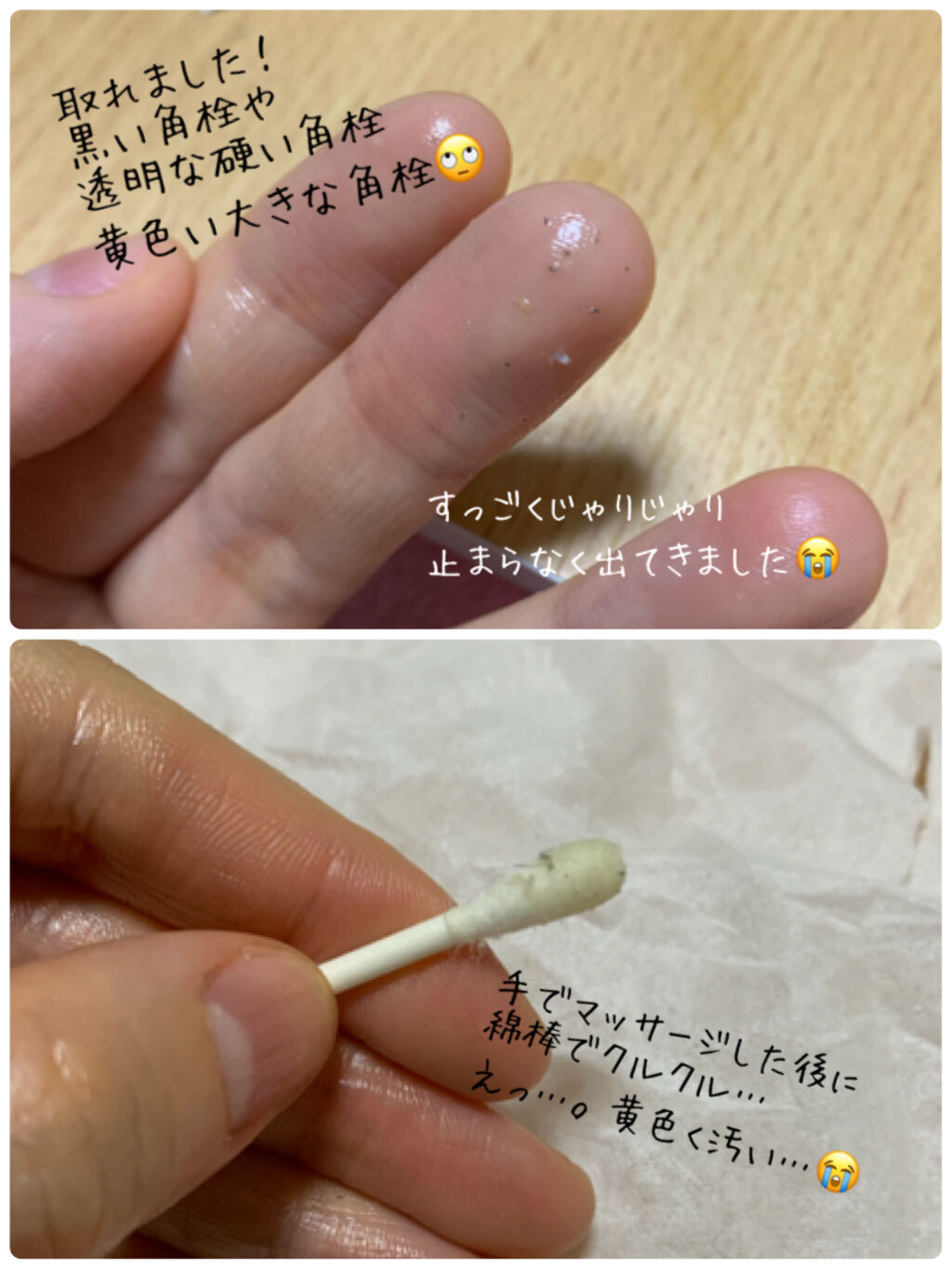 対処 エキス パドル 綿棒 オイル 角 栓 とれ ない Ikkyou Jp
