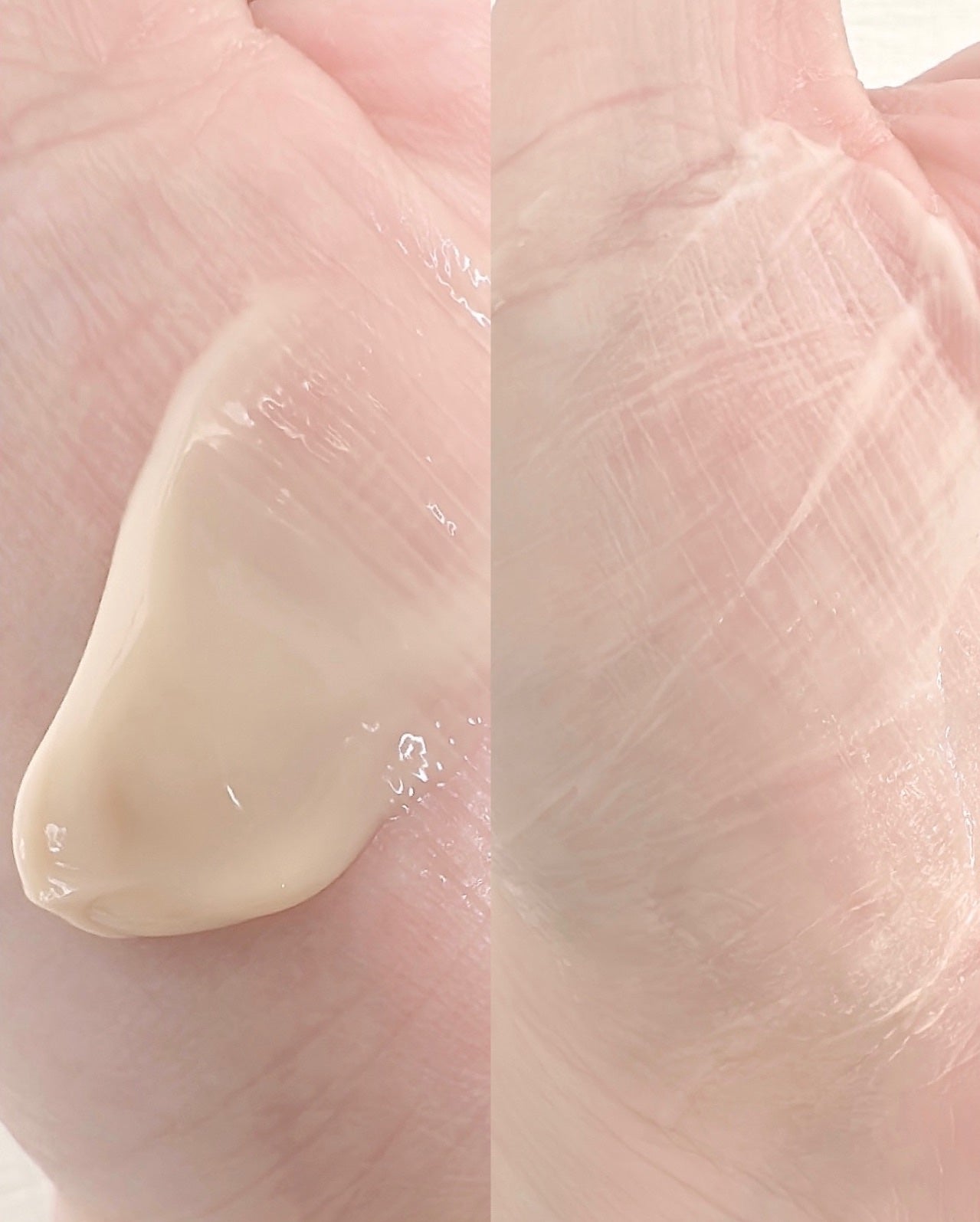 Cemenrete Calcium Intense Cream/Dr.Melaxin/フェイスクリームを使ったクチコミ(5枚目)