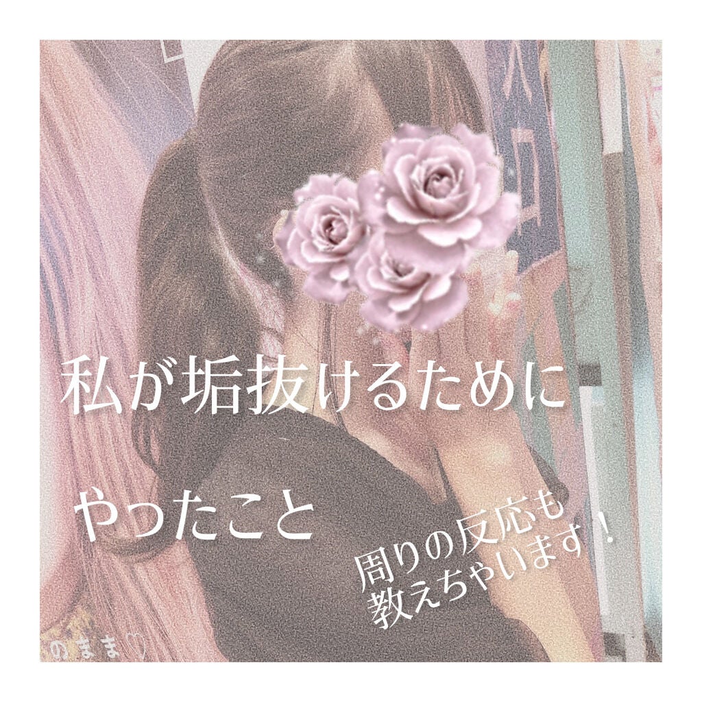 除毛クリームキット敏感肌用/エピラット/除毛クリームを使ったクチコミ(1枚目)