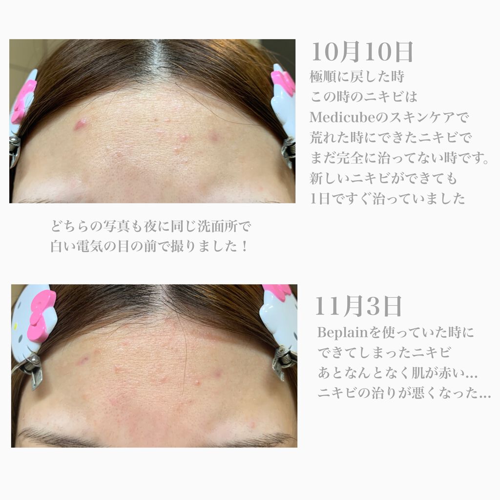 緑豆弱酸性クレンジング/beplain/クレンジングクリームを使ったクチコミ（3枚目）