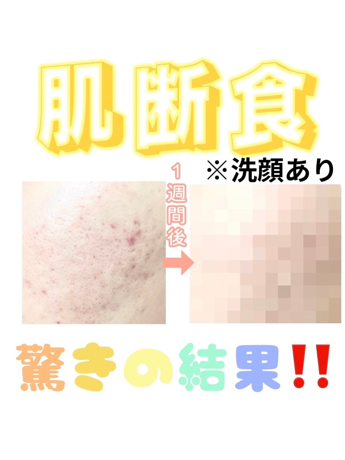綴 on LIPS 「【肌断食で驚きの結果に!?】こんにちは、綴です🙌🏻つい最近コロ..」(1枚目)