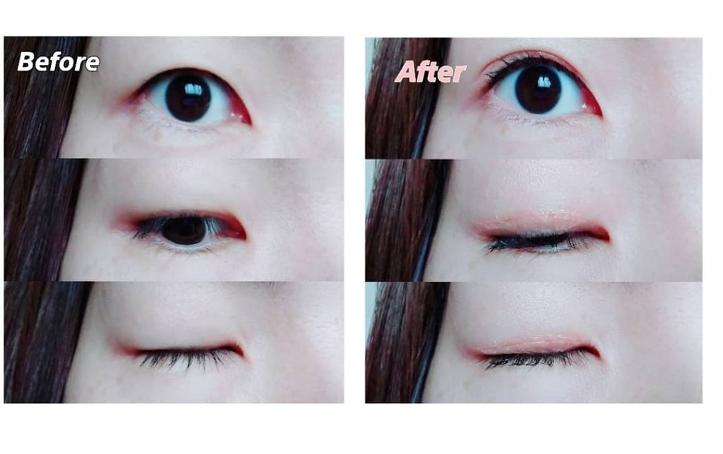 ORIPUCHI/Girl's Maker/二重まぶた用アイテムを使ったクチコミ(4枚目)