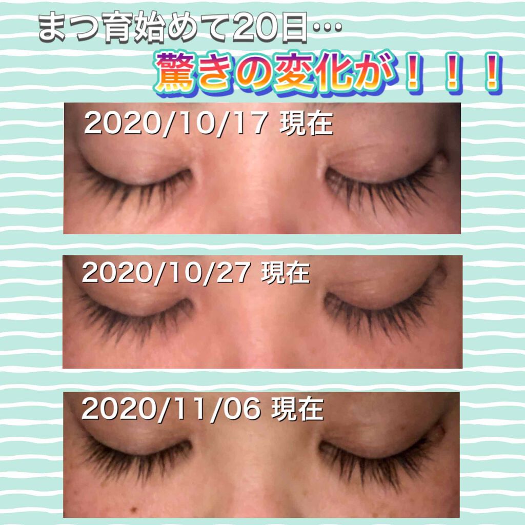 スカルプD ボーテ ピュアフリーアイラッシュセラム プレミアム/アンファー(スカルプD)/まつげ美容液を使ったクチコミ(1枚目)