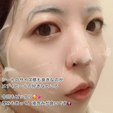 ビタライトビームエッセンシャルマスクEX/MEDIHEAL/シートマスク・パックを使ったクチコミ(4枚目)
