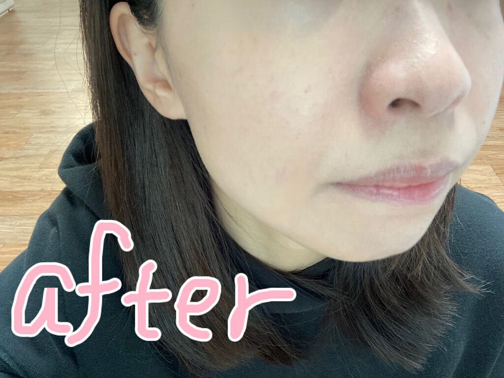 ピーチスキンフィッティングベース/espoir/化粧下地を使ったクチコミ(6枚目)