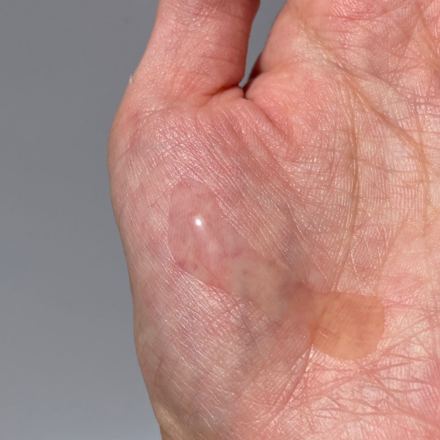 グルタシカ Vセラム/Dr.Viuum/美容液を使ったクチコミ(3枚目)