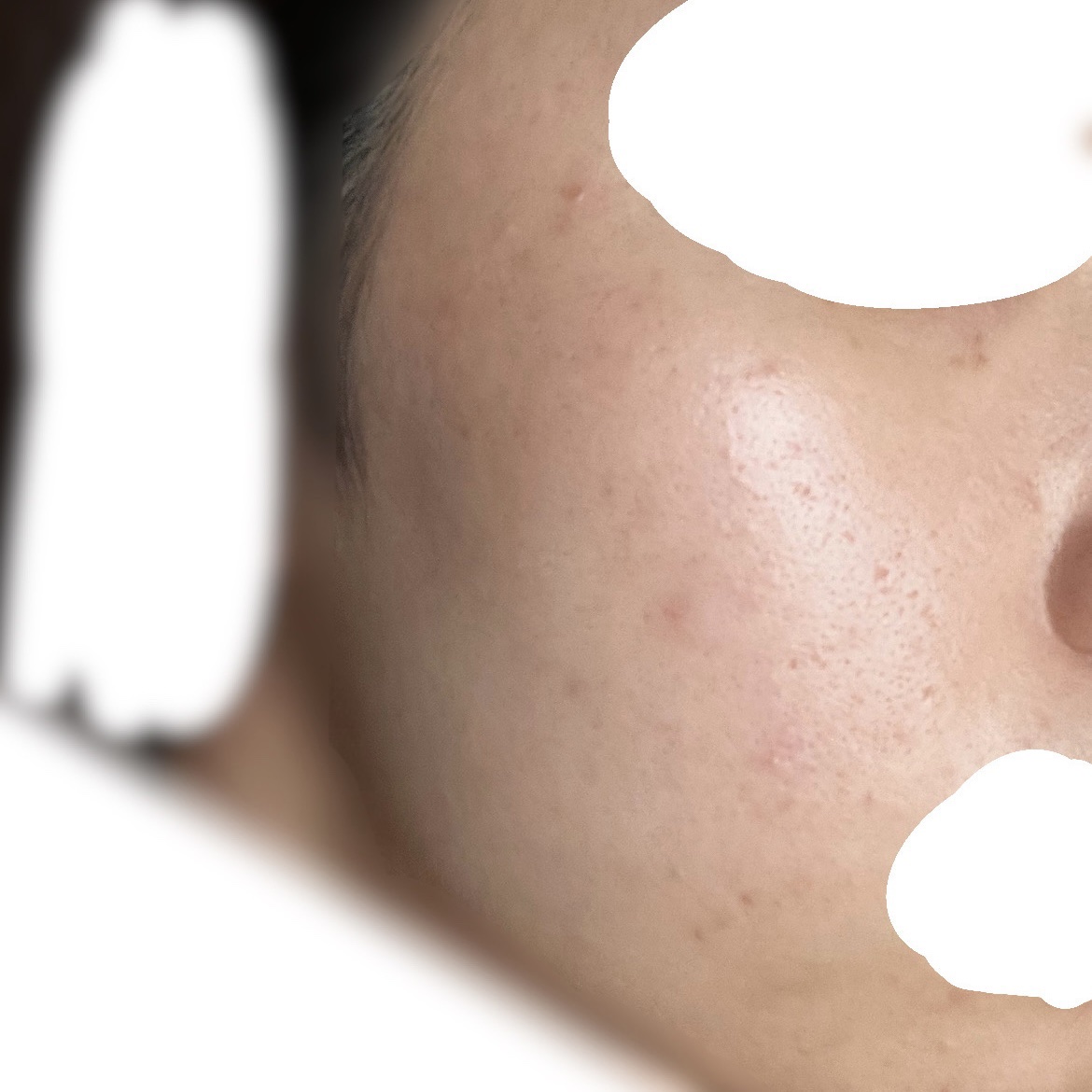 ティーツリーケア ソリューション エッセンシャルマスクEX/MEDIHEAL/シートマスク・パックを使ったクチコミ（2枚目）