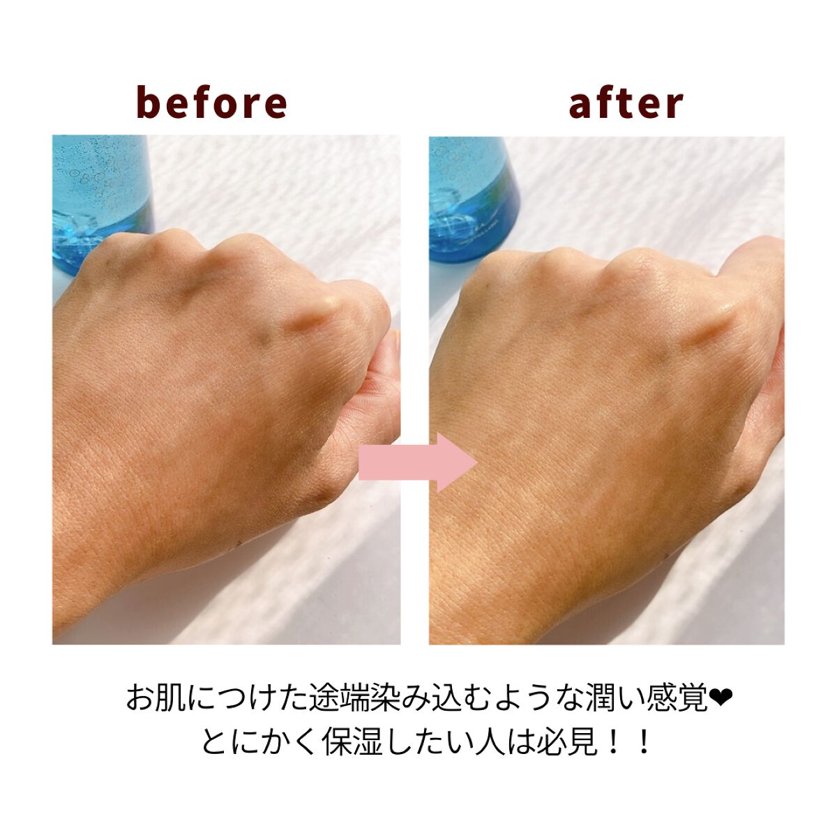 MiHO♡さん専用 フォーミングＷ２、ソフトローション3 薬用マイクロバブルローション｜Macchia Labelの口コミ - 敏感肌に