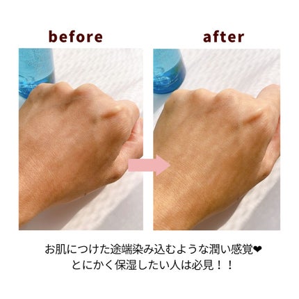 薬用マイクロバブルローション/Macchia Label/化粧水を使ったクチコミ(1枚目)