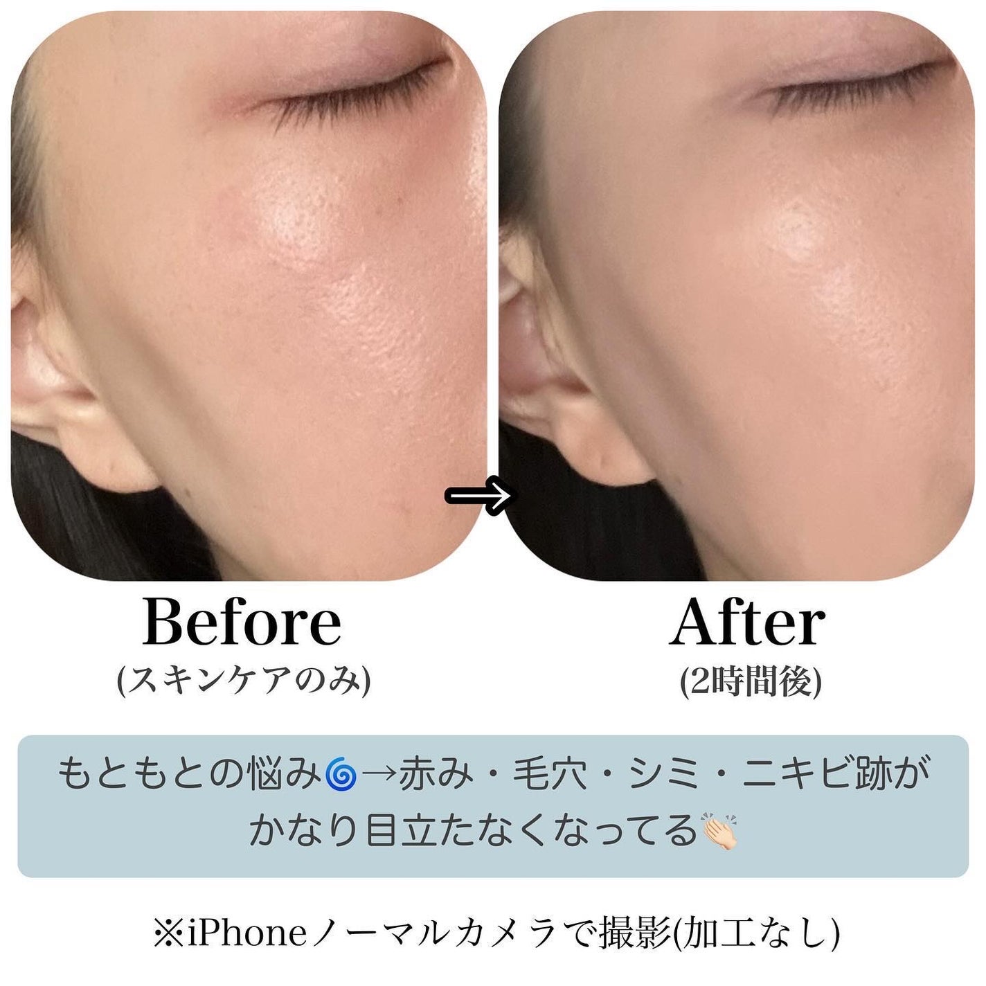 グロー マットクッション/APRILSKIN/クッションファンデーションを使ったクチコミ(4枚目)