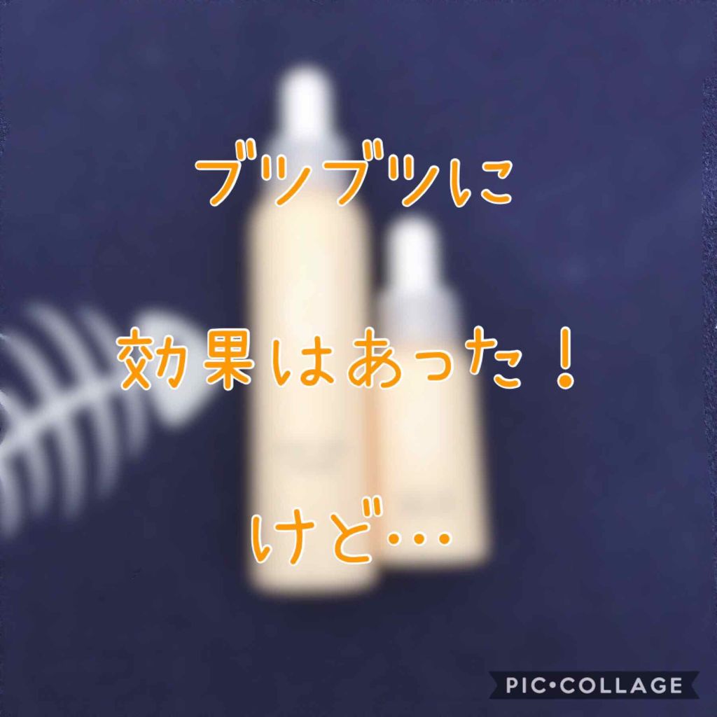 アクネケア セット N/d プログラム/トライアルキットを使ったクチコミ(1枚目)