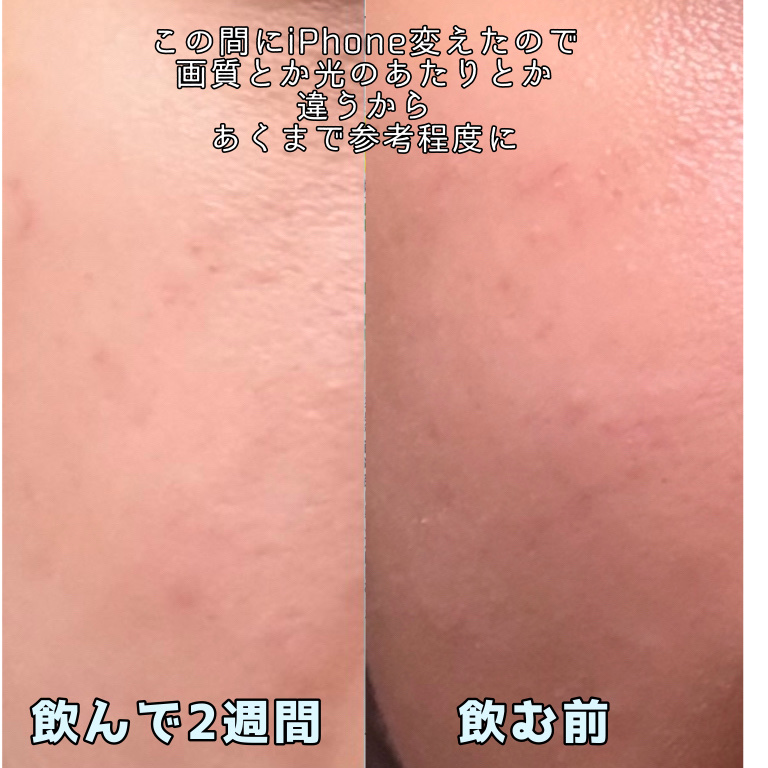 DHC はとむぎエキス/DHC/健康サプリメントを使ったクチコミ（2枚目）