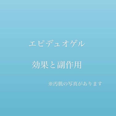 幸子 on LIPS 「皮膚科で貰ったエピデュオゲルを使用して１ヶ月後が経ったので、レ..」（1枚目）