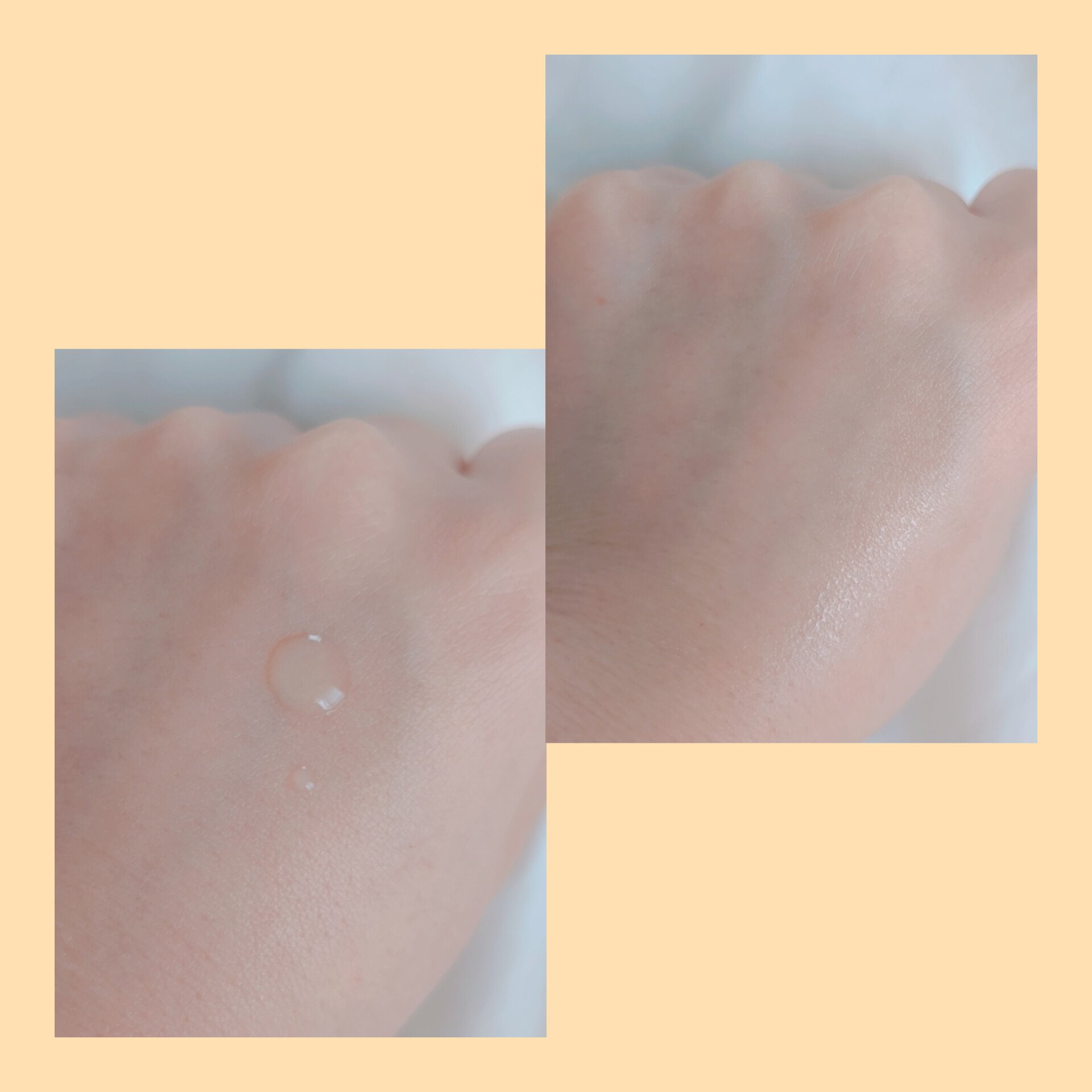 ナイアシンアミドブレミッシュケアセラム/ONE THING/美容液を使ったクチコミ（2枚目）