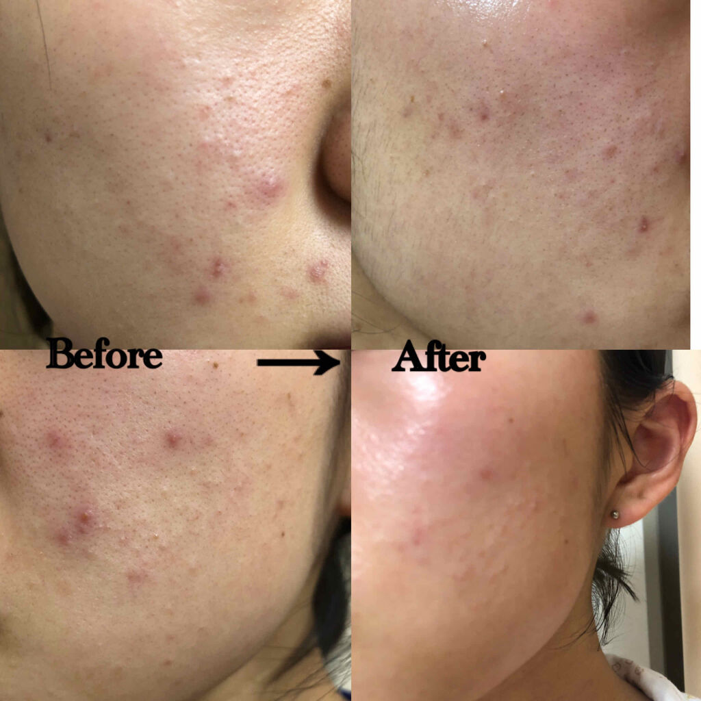 クリアトライアルセット M（しっとりタイプ）/オルビス/トライアルキットを使ったクチコミ（2枚目）