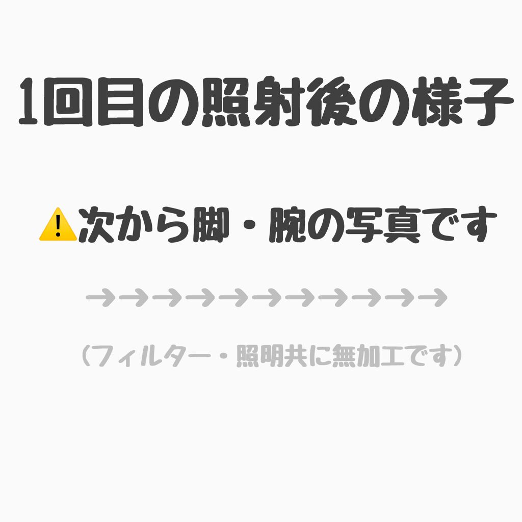 光脱毛器 VIO/Sarlisi/家庭用脱毛器を使ったクチコミ（2枚目）