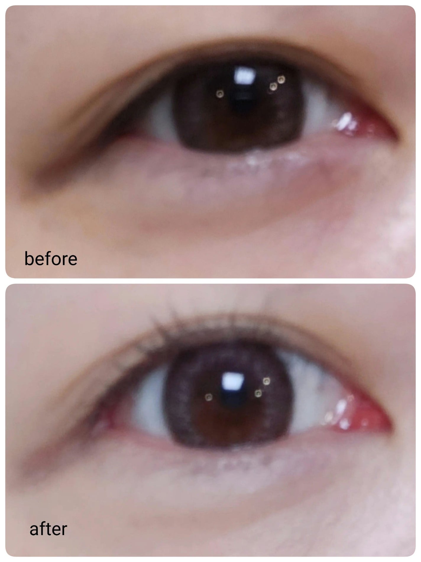 アイレノール クマクリーム/IRENOL/アイケア・アイクリームを使ったクチコミ(3枚目)