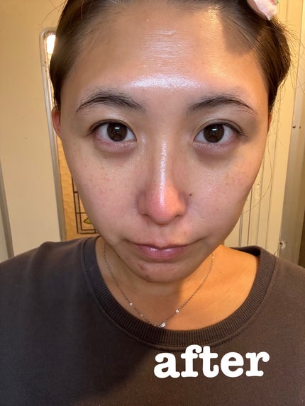 ビタナイアシンアミド リアルディープマスク/Biodance/シートマスク・パックを使ったクチコミ(5枚目)