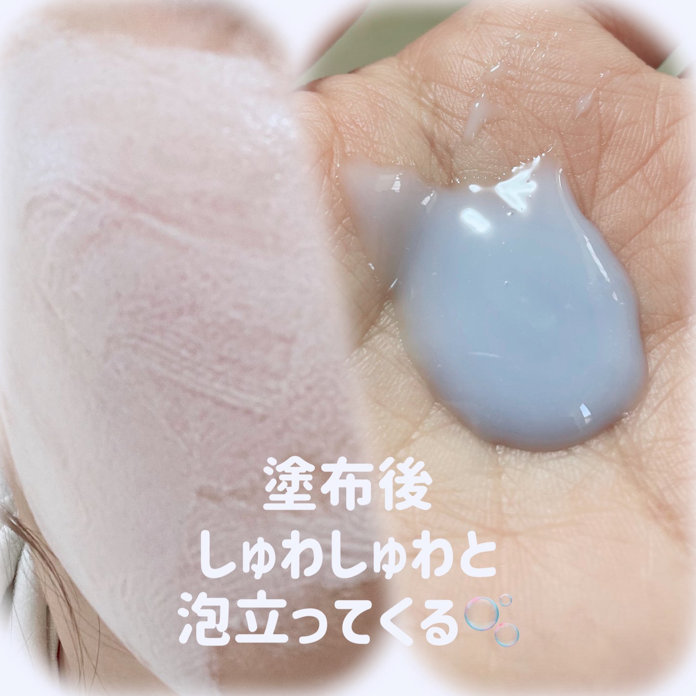 ペプチド ボリューム マスター エッセンス/DR.PEPTI/美容液を使ったクチコミ(2枚目)