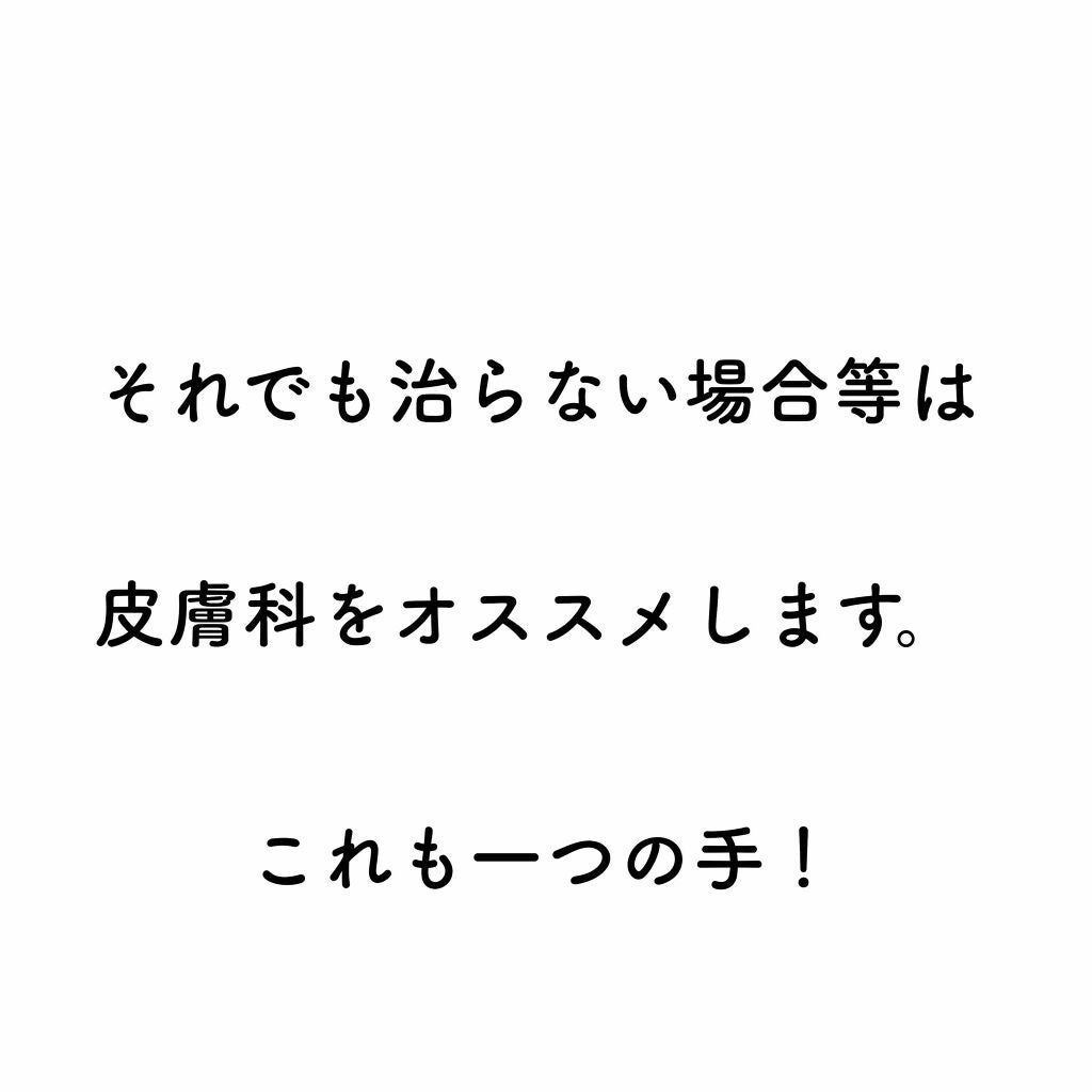 マシュマロホイップ モイスチャー/ビオレ/泡洗顔を使ったクチコミ(3枚目)