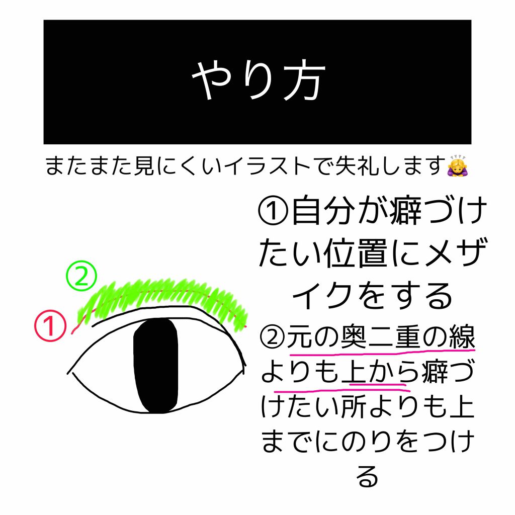 ナイトアイボーテ/StreeTrend/二重まぶた用アイテムを使ったクチコミ(3枚目)