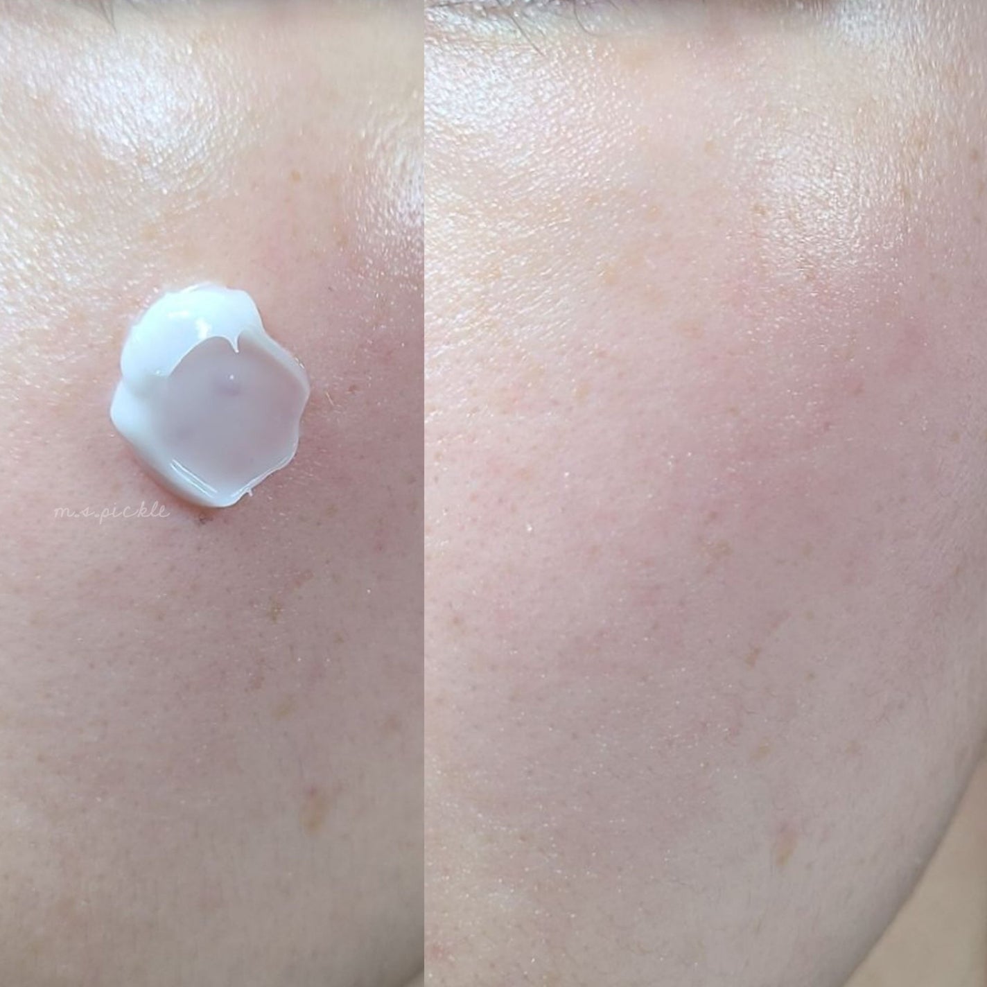 ドクタージー バクチオールポアジェットクリーム/Dr.G/フェイスクリームを使ったクチコミ(4枚目)