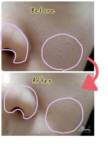 アンクル ド ポー ルクッションN/YVES SAINT LAURENT BEAUTE/クッションファンデーションを使ったクチコミ(2枚目)