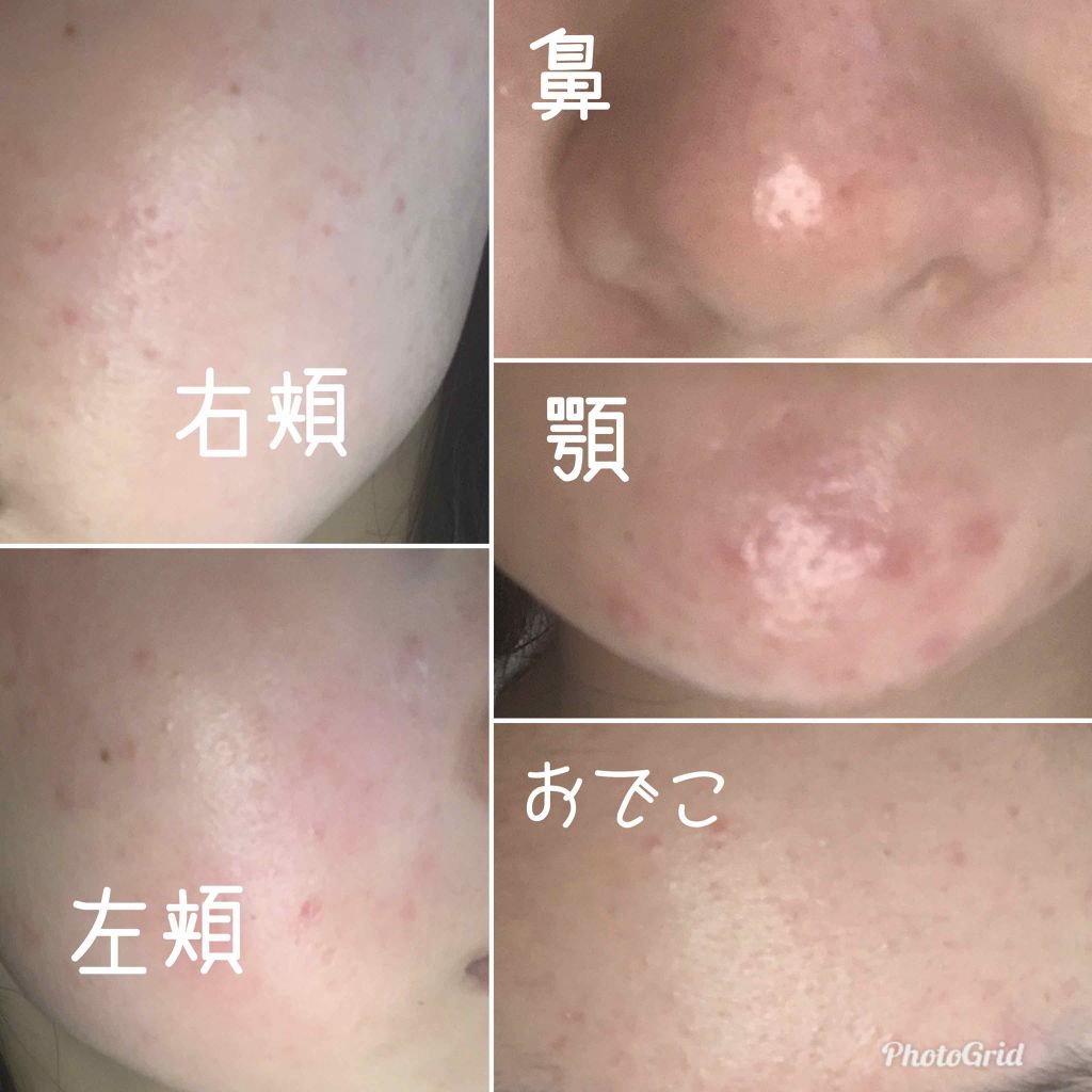 ãã
âºïžð on LIPS ãçãããããã«ã¡ã¯âšãã
ã§ãðèæ¥èš3æ¥ç®ã§ãððèã®èª¿åãšã..ãïŒ2æç®ïŒ