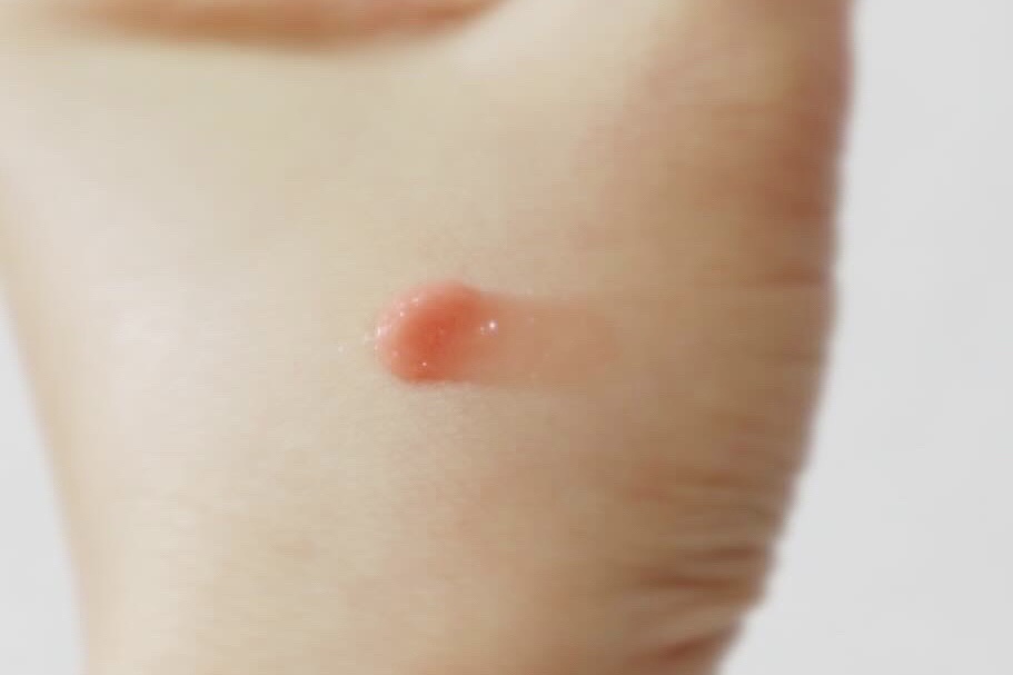 リップスリーピングマスク/LANEIGE/リップバームを使ったクチコミ（3枚目）