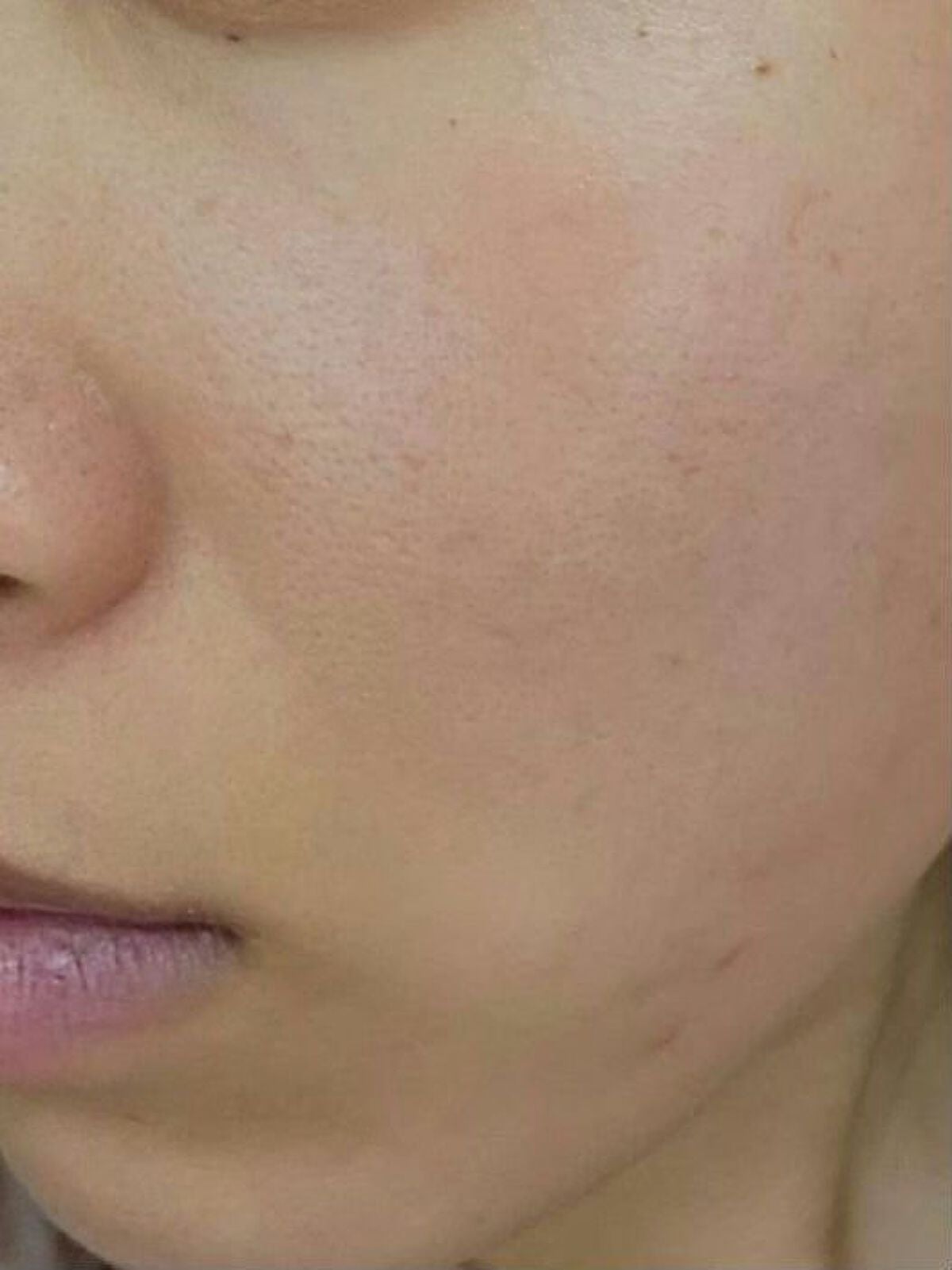 レチノールA 1% アドバンスドリバイタリゼーションクリーム/Life-flo/フェイスクリームを使ったクチコミ(8枚目)