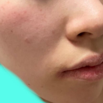 クリーンイットゼロ クレンジングバーム オリジナル/BANILA CO/クレンジングバームを使ったクチコミ(3枚目)