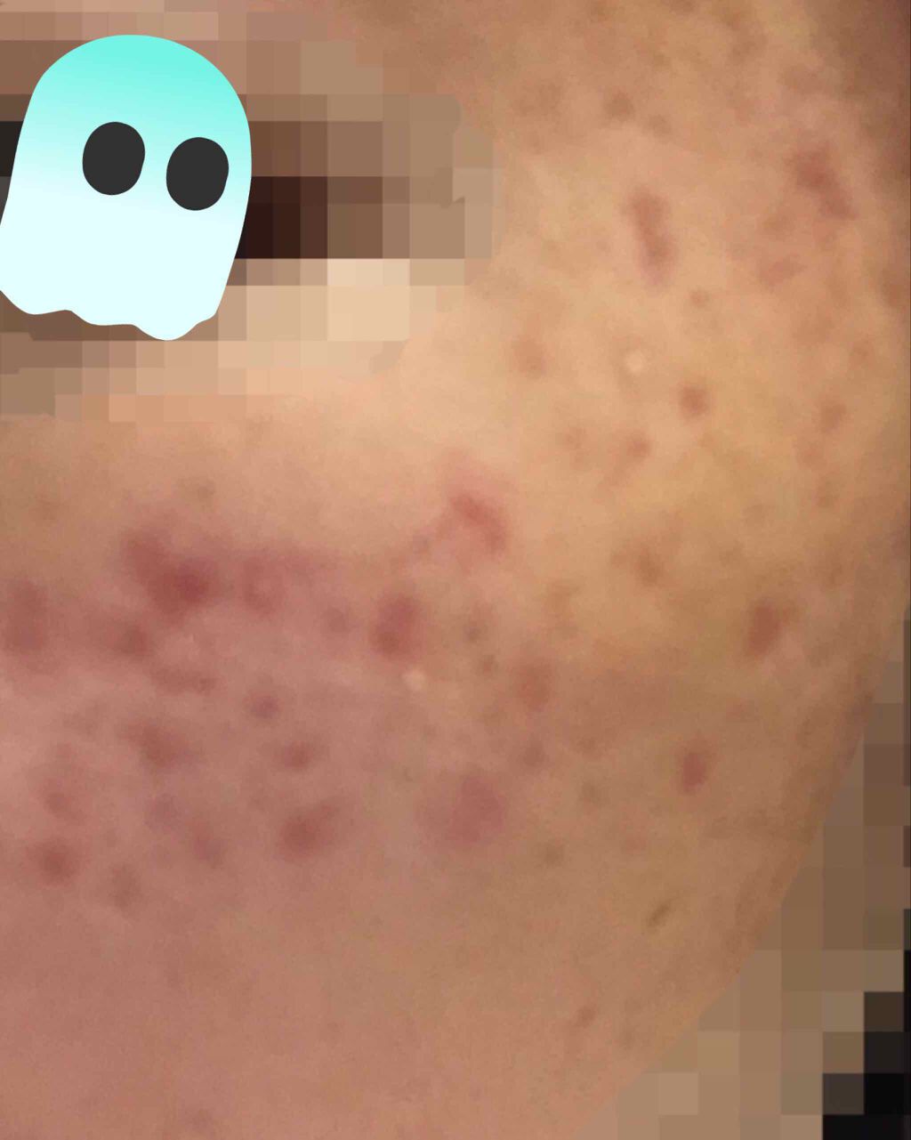 ⭐️kotone⭐️ on LIPS 「⚠️助けてください⚠️初めまして!ことねと申します!初投稿がこ..」(2枚目)