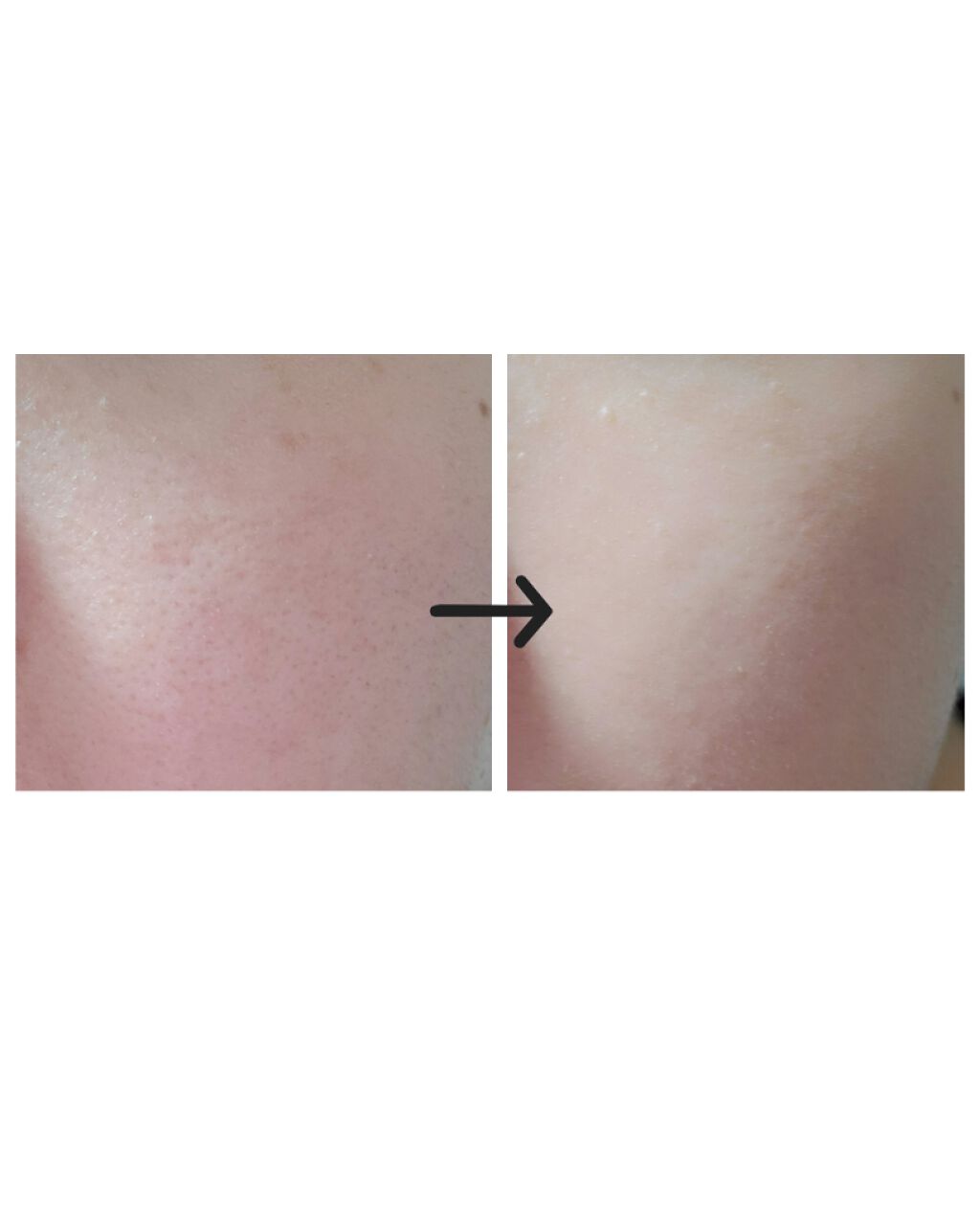 フィットミー リキッドファンデーション R/MAYBELLINE NEW YORK/リキッドファンデーションを使ったクチコミ(2枚目)