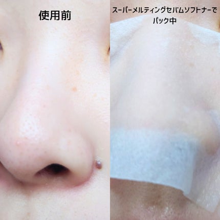 ディープクリーンマスター/ilso/その他スキンケアグッズを使ったクチコミ(4枚目)