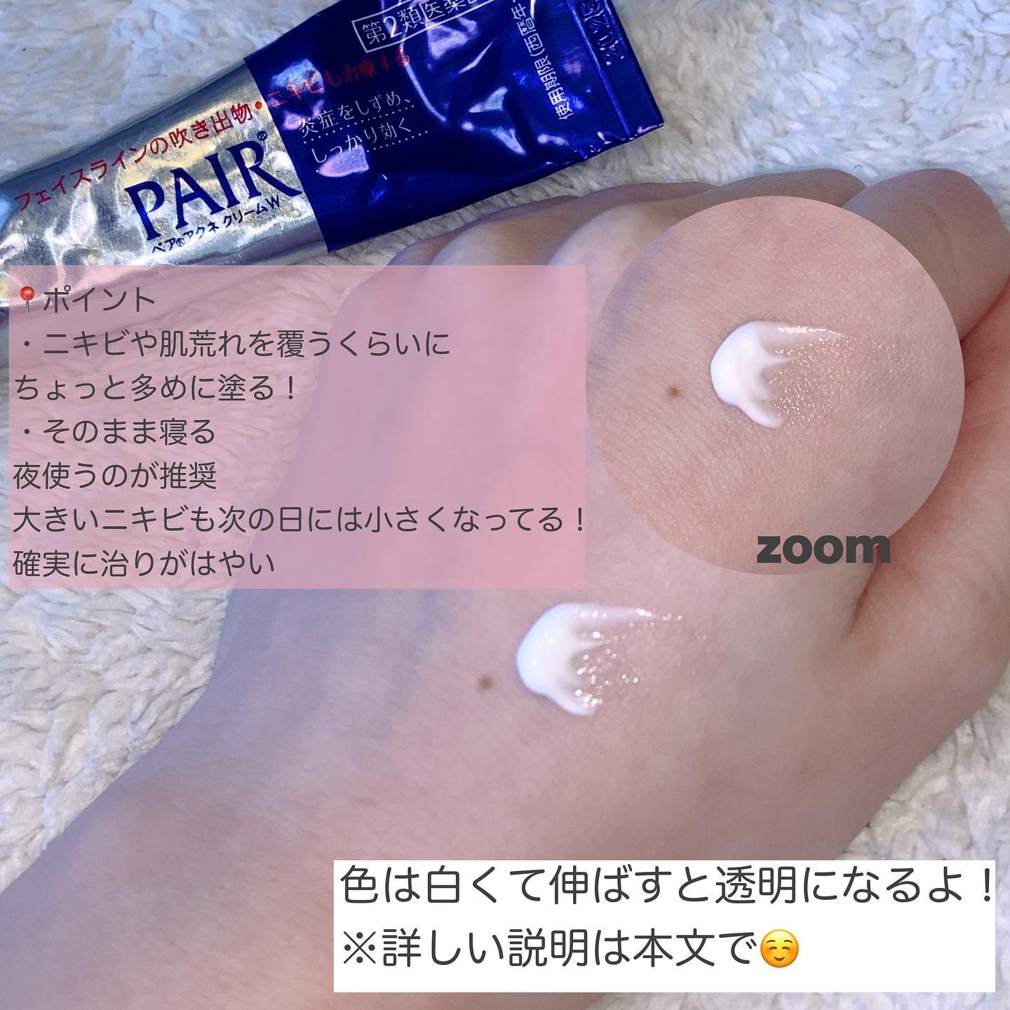 ペアアクネクリームW(医薬品)/ペア/その他を使ったクチコミ（3枚目）